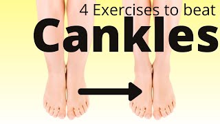 4 exercises to define your calves  lose cankles fast [upl. by Goldston925]