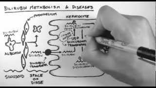 Sjögren’s Syndrome  Diagnosis  Johns Hopkins [upl. by Nagle332]