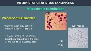 Interpretation of Stool Examination [upl. by Elimay329]