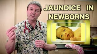 Jaundice in Newborns Pediatric Advice [upl. by Halfdan]