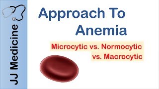 Anemia  Microcytic vs Normocytic vs Macrocytic [upl. by Notac]