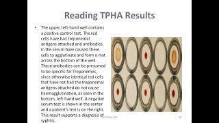 TPHA TestPositive [upl. by Ttekcirc296]