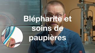 Blépharite et soins des paupières  COF [upl. by Suneya653]