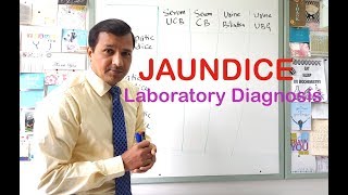 Jaundice  Laboratory Diagnosis [upl. by Fey]