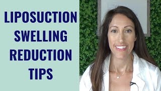 Liposuction Healing amp Recovery Tips  How to REDUCE Lipo Swelling  Post Liposuction Care Guide [upl. by Law]