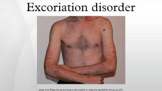 Excoriation disorder [upl. by Eilagam]