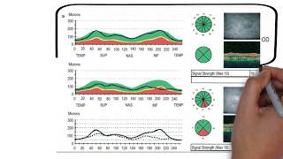 Optical Coherence Tomography  OCT  part1 [upl. by Keary]