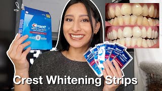 I TRIED THE CREST 3D WHITESTRIPS FOR 14 DAYS Effective  Before amp After pictures [upl. by Olivie]