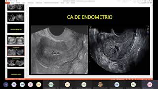 Práctica de HisterosalpingografíaHisterosonografía y rx simple de abdomen  4ta práctica Dr Amaro [upl. by Rust]