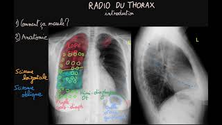 AVS quotLa radiologie clé du diagnostic médicalquot avec The French Radiologist [upl. by Chandal]