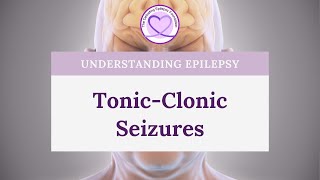 What are TonicClonic Seizures [upl. by Yelrac]