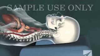 Cervical Chiropractic Adjustment [upl. by Levison]