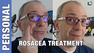 Rosacea Mirvaso Gel Cream Treatment Test  Geek Vlog 376 Rosacea [upl. by Lothaire]