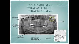 Radiographic Interpretation of Dental Anatomy [upl. by Wina]