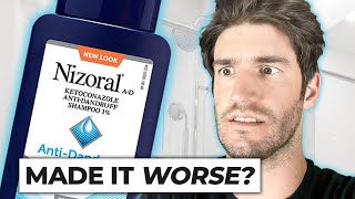 Nizoral Shampoo For Hair Loss  THE TRUTH [upl. by Algernon]