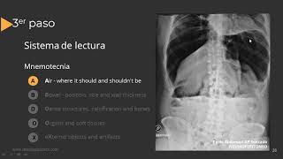 Radiografía de Abdomen Paso a Paso [upl. by Haeli850]