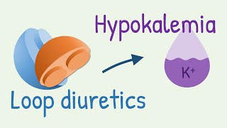 How diuretics cause hypokalemia [upl. by Tia97]