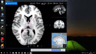 Dicom Image Viewer for Windows [upl. by Ecnatsnoc]