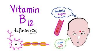 Vitamin B12 Cobalamin Deficiency  Causes Symptoms Diagnosis amp Management  Hematology Series [upl. by Robbert]