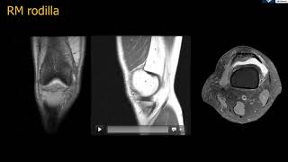 Anatomía RM Rodilla [upl. by Nor]