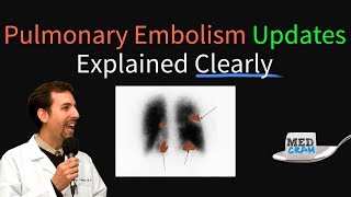 Pulmonary Embolism  Thromboembolism Updates Explained Clearly [upl. by Arlana554]