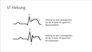 EKG verstehen die Grundlagen EKG Crashkurs Teil 1 [upl. by Cavill]