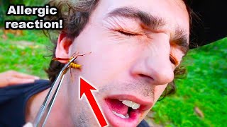 STUNG in FACE by an EXECUTIONER WASP Exposed Coyote Peterson [upl. by Vey]