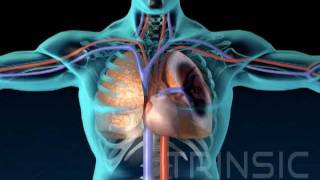 Pulmonary Embolism Medical Animation [upl. by Caruso]