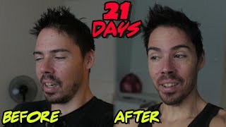 21 Day Water Fast What I Healed and What Id Do Different [upl. by Annagroeg20]