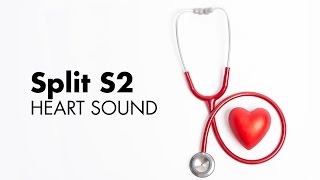 Fixed Split S2  Heart Sounds  MEDZCOOL [upl. by Kwok]