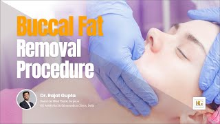 Buccal Fat Removal Surgery  Cheek Fat Reduction  Face slimming Dr Rajat Gupta  RG Aesthetics [upl. by Publias]