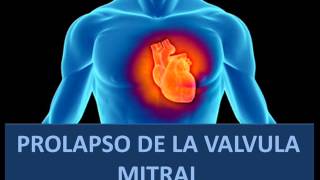 Soplo del prolapso valvular mitral [upl. by Eerat]