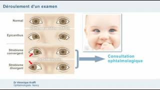 Examen ophtalmologique et dépistage des anomalies oculaires chez lenfant [upl. by Suellen]