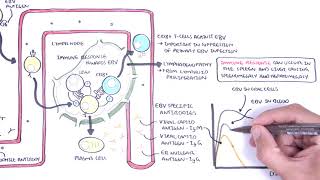 Epstein Barr Virus and Infectious Mononucleosis pathophysiology investigations and treatment [upl. by Adhern]