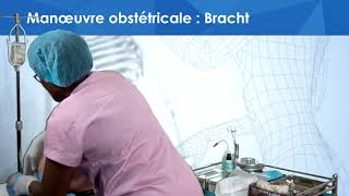 Manœuvre obstétricale  Bracht [upl. by Caralie]