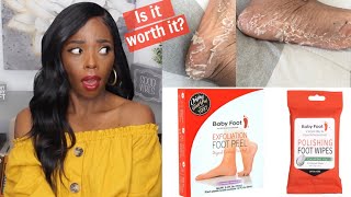 REVIEW Baby Foot Exfoliation Foot Peel THE TRUTH Pros amp Cons Real Photos [upl. by Robinson]