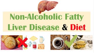 NonAlcoholic Fatty Liver Disease amp Diet  Diets to Prevent and Reduce Severity of NAFLD [upl. by Scurlock]