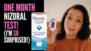 HAIR LOSS SUFFERER REVIEWS NIZORAL SHAMPOO One Month Review On 2 Ketoconazole IM VERY SURPRISED [upl. by Konrad526]