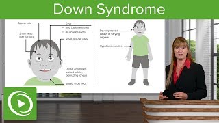 Down Syndrome – Genetics  Lecturio [upl. by Stieglitz]