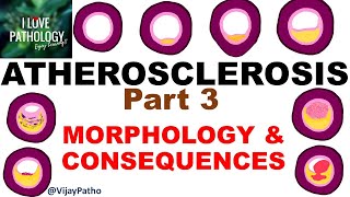 ATHEROSCLEROSIS Part 3  Morphology and consequences [upl. by Alford244]