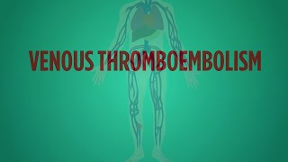 Arterial Thrombosis Vs Venous Thrombosis  Clear Comparison [upl. by Brockie]