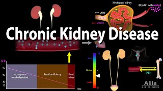 Chronic Kidney Disease Animation [upl. by Adnac]