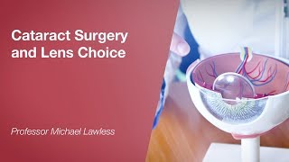 Cataract Surgery and Lens Choice [upl. by Ynahpets]