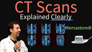 Radiology Rounds 06 Normal CT segmental Lung Anatomy [upl. by Xet889]