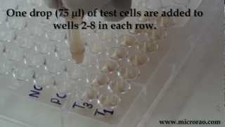 Treponema Pallidum Hemagglutination TPHA test for syphilis [upl. by Zavala]