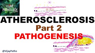 ATHEROSCLEROSIS  Part 2 Pathogenesis [upl. by Swan]