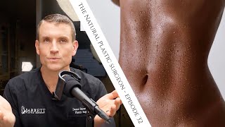 32 Everything You Need To Know About Liposuction [upl. by Kaslik]