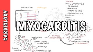 Myocarditis  causes pathophysiology investigation and treatment [upl. by Keon]