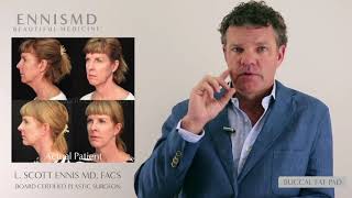 Buccal Fat Pad Removal Surgery with Dr L Scott Ennis [upl. by Botti150]