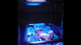 Neonatal Jaundice [upl. by Agnese496]